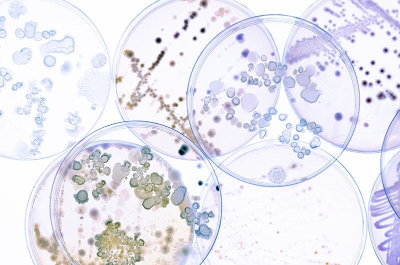 Differences between Bifidobacterium longum and Bifidobacterium breve Differences between Bifidobacterium longum and Bifidobacterium breve